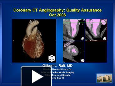 cardiac ct angiography ppt