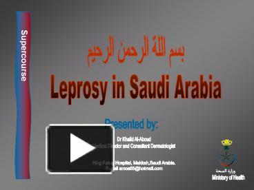 PPT LEPROSY PowerPoint presentation free to download id: 226389 ZDc1Z