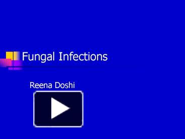 Fungal Infections presentation | free to view
