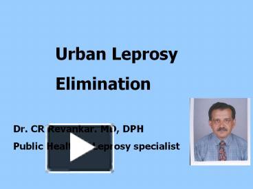 PPT Urban Leprosy Problem PowerPoint presentation free to download