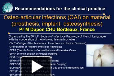 Tibia hardware removal recovery time image