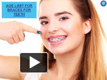 Age Limit For Braces For Teeth Orthodontic Experts presentation