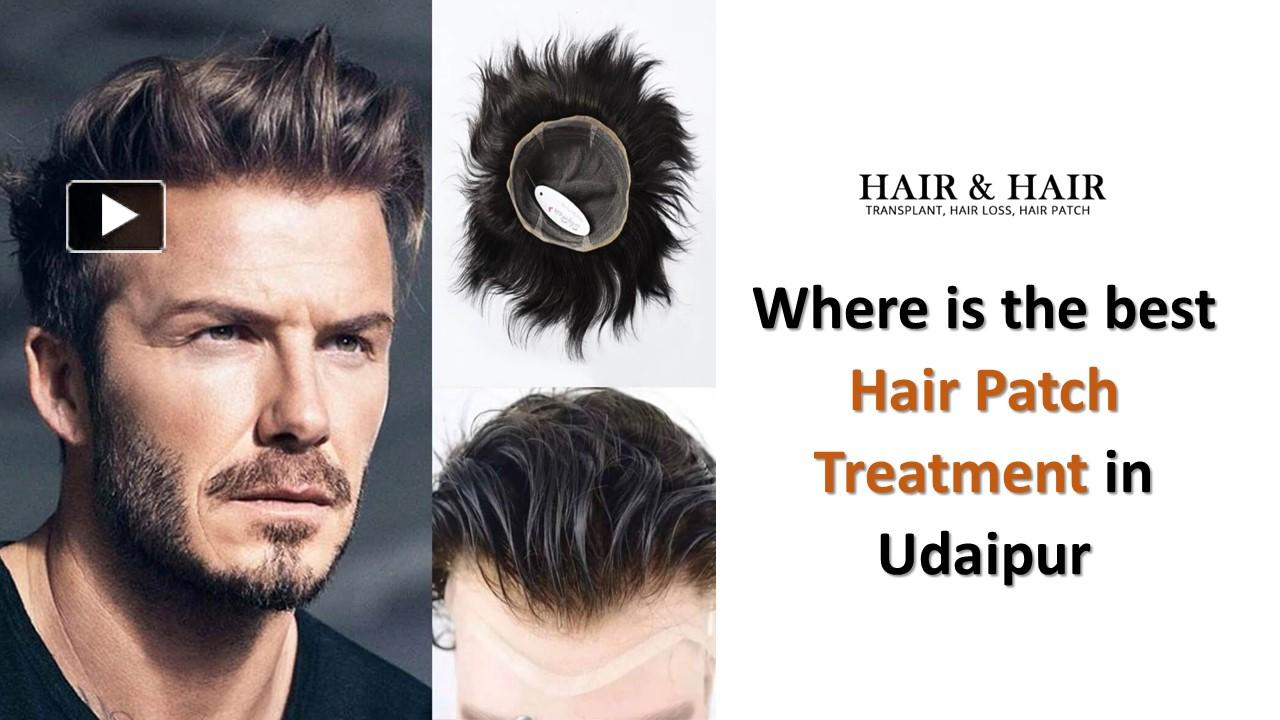 PPT Where Is The Best Hair Patch Treatment In Udaipur PowerPoint 