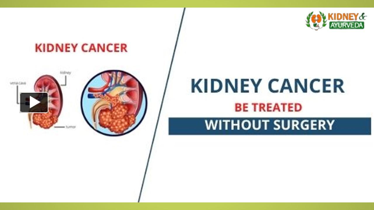 PPT Can Kidney Cancer Be Treated Without Surgery PowerPoint