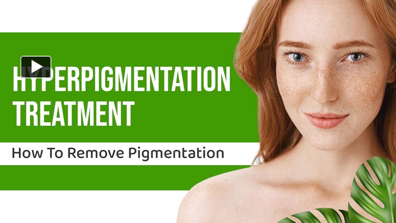 PPT Hyperpigmentation Treatment How To Remove Pigmentation (1