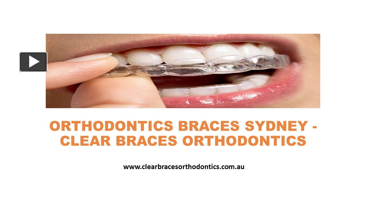 PPT Clear Braces Orthodontics Orthodontics Braces Sydney PowerPoint