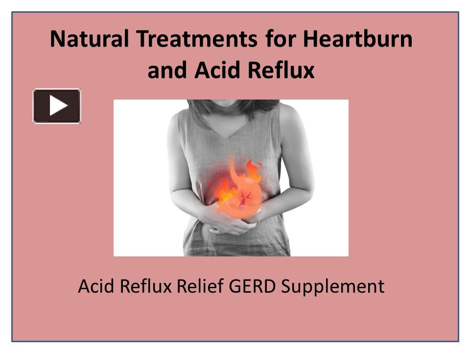 ppt-natural-remedies-for-the-treatment-of-acidity-powerpoint