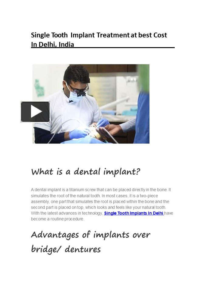 PPT Single Tooth Implant Treatment at best Cost In Delhi, India PowerPoint presentation free