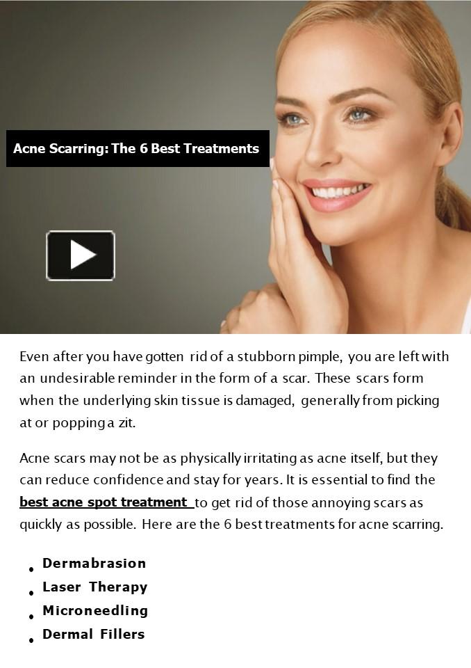 PPT Acne Scarring The 6 Best Treatments PowerPoint presentation
