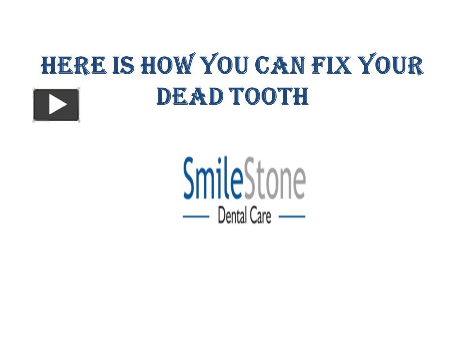 PPT Here Is How You Can Fix Your Dead Tooth PowerPoint presentation
