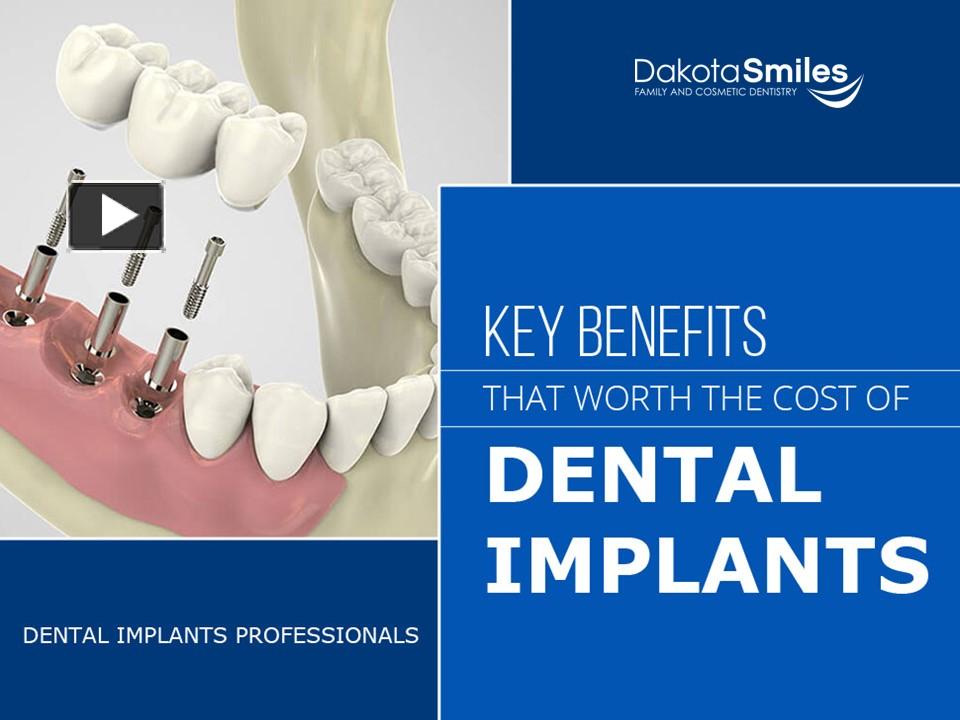 PPT Dental Implants in Fargo Dakota Smiles Family and Cosmetic
