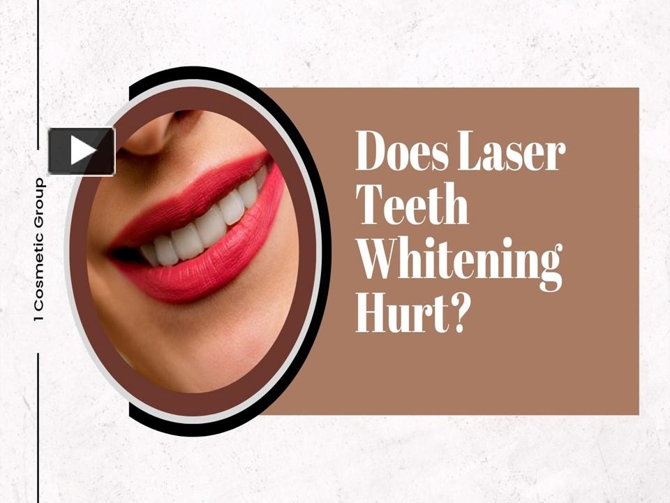 PPT Does Laser Teeth Whitening Hurt? PowerPoint presentation free