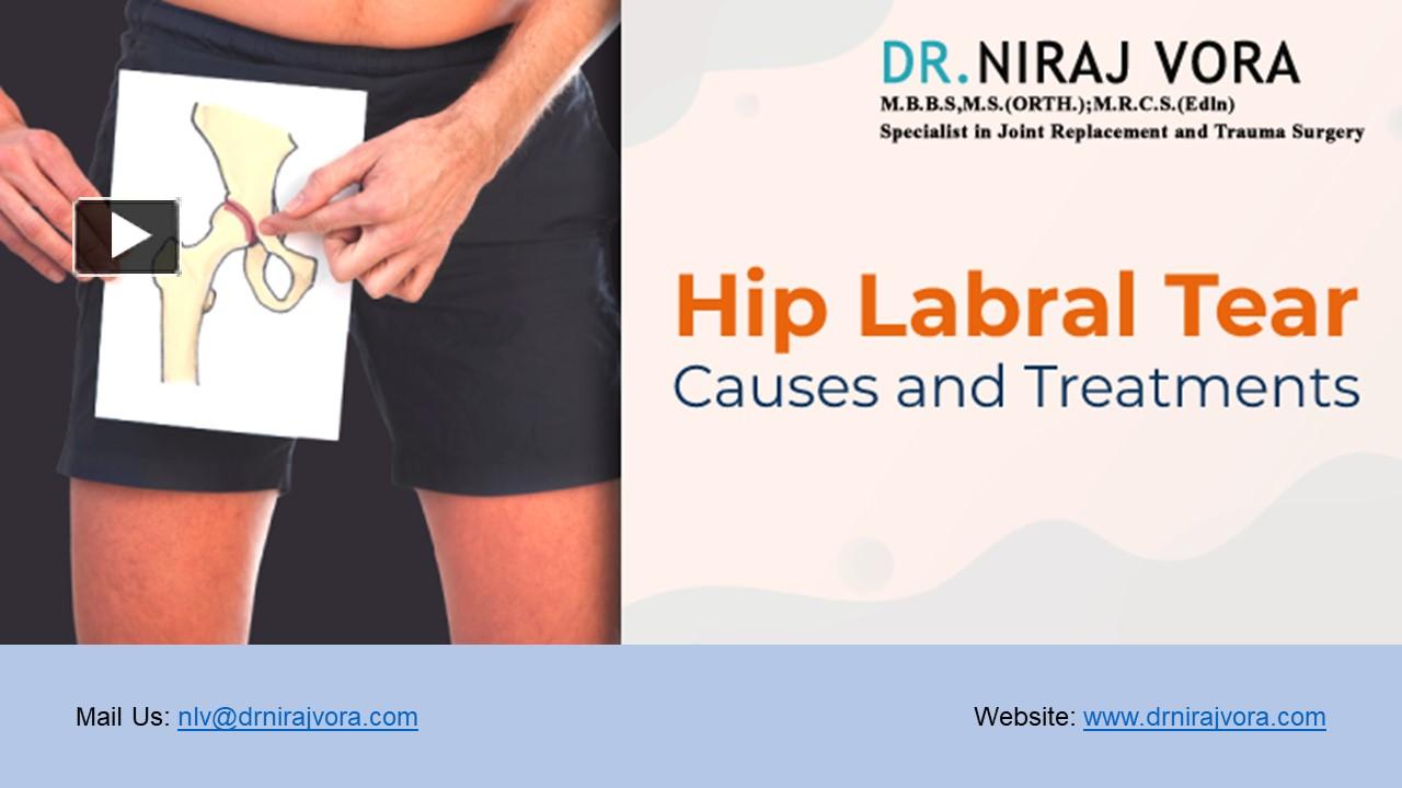 PPT Hip Labral Tear Symptoms Causes and Treatments Dr Niraj Vora