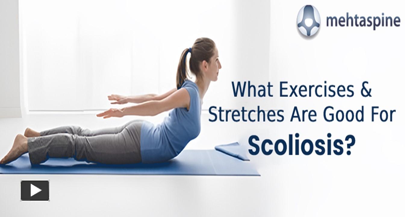 PPT What Exercises & Stretches Are Good For Scoliosis? PowerPoint