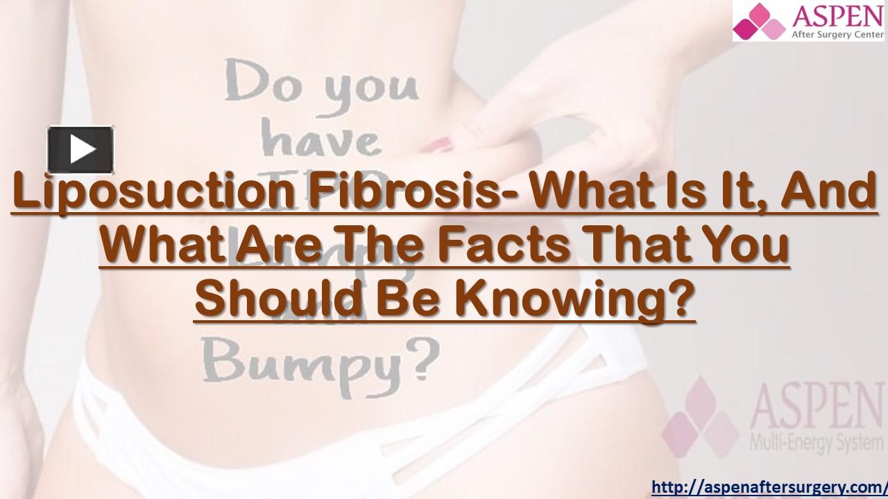 PPT Liposuction Fibrosis What Is It, And What Are The Facts That You