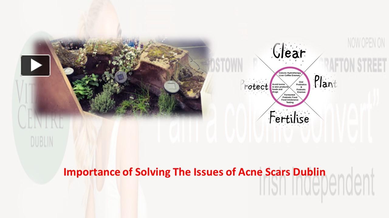 PPT Importance of Solving The Issues of Acne Scars Dublin PowerPoint