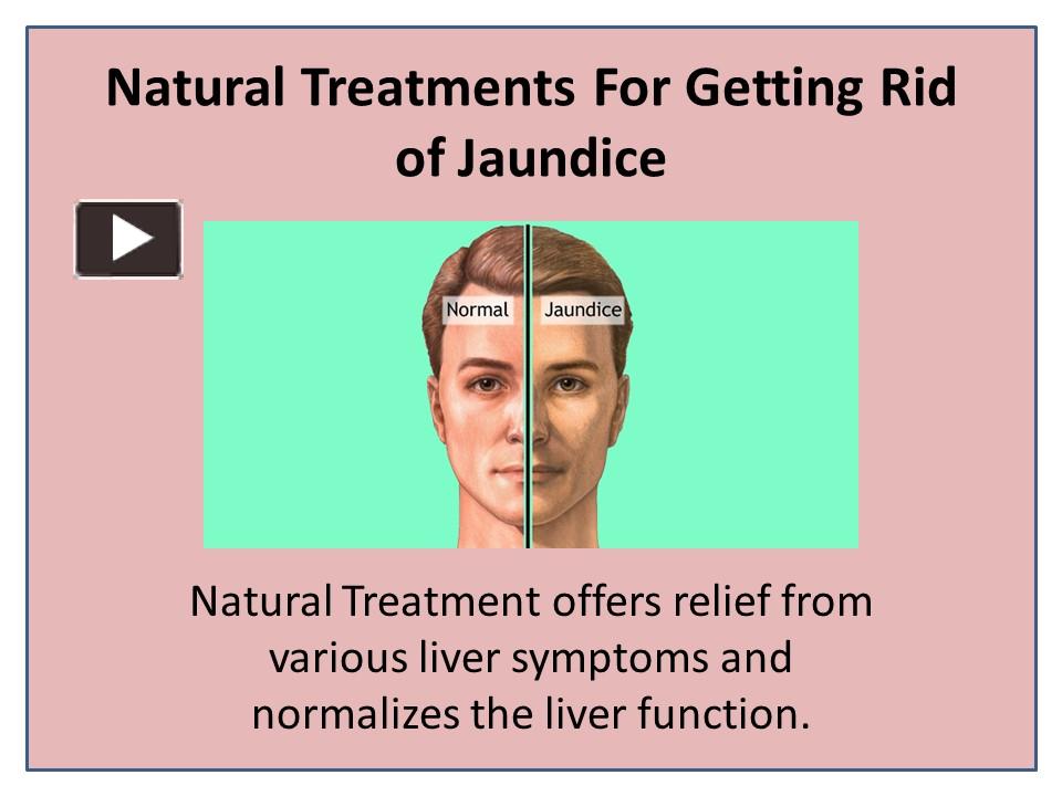 PPT Cure Jaundice and Reduce Bilirubin Level with Herbal Capsule PowerPoint presentation