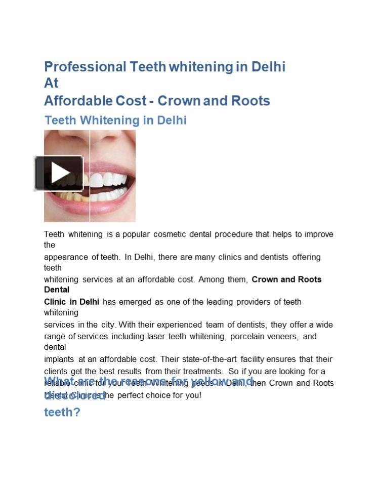 PPT Professional Teeth whitening in Delhi At Affordable Cost Crown and Roots PowerPoint