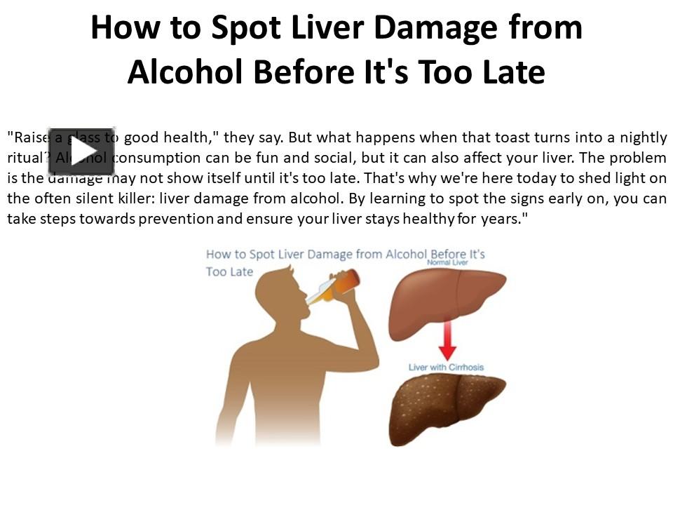 PPT Methods for Detecting AlcoholInduced Liver Damage Early