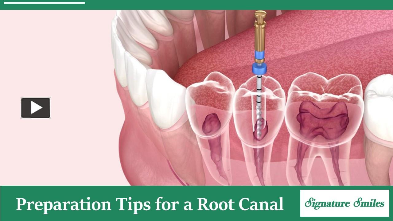 PPT A Comprehensive Guide How to Prepare for a Root Canal PowerPoint