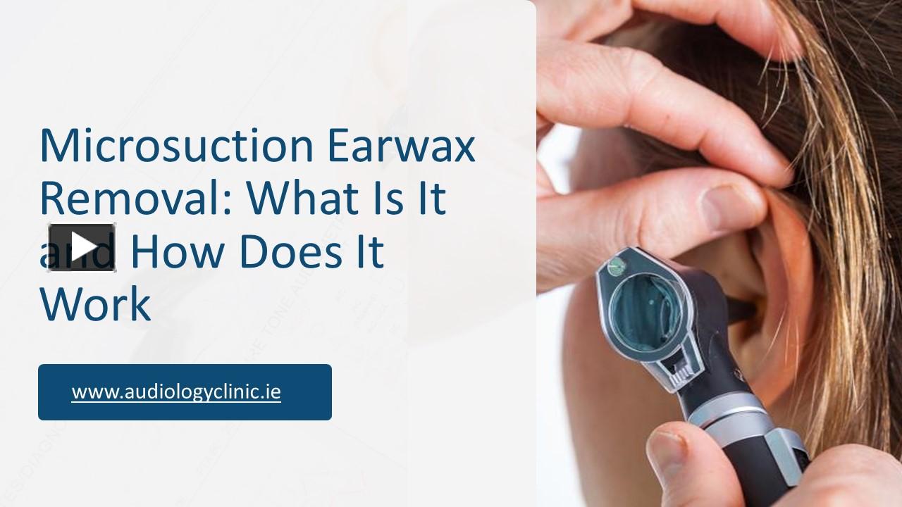 PPT Microsuction Earwax Removal What Is It and How Does It Work