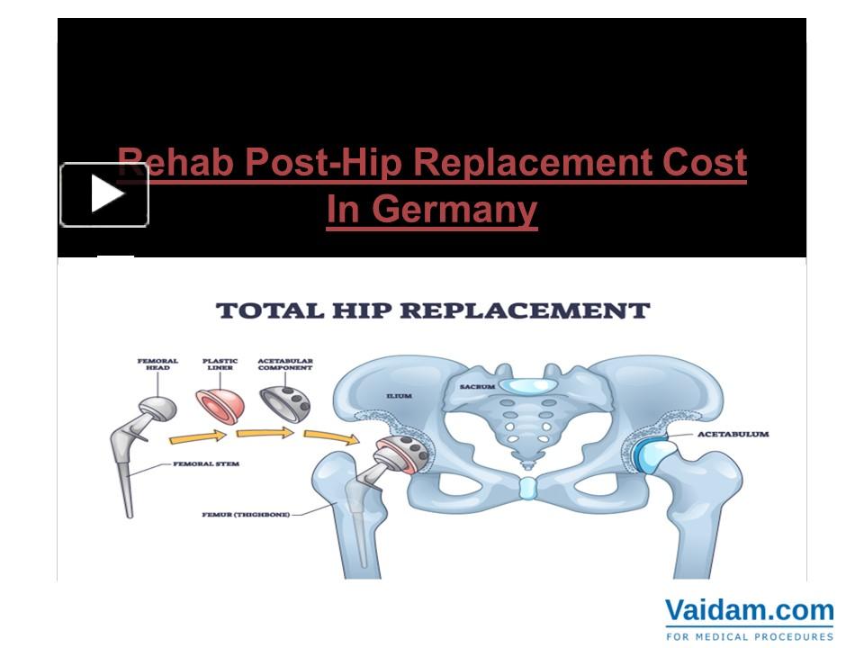 PPT Rehab PostHip Replacement Cost In Germany PowerPoint