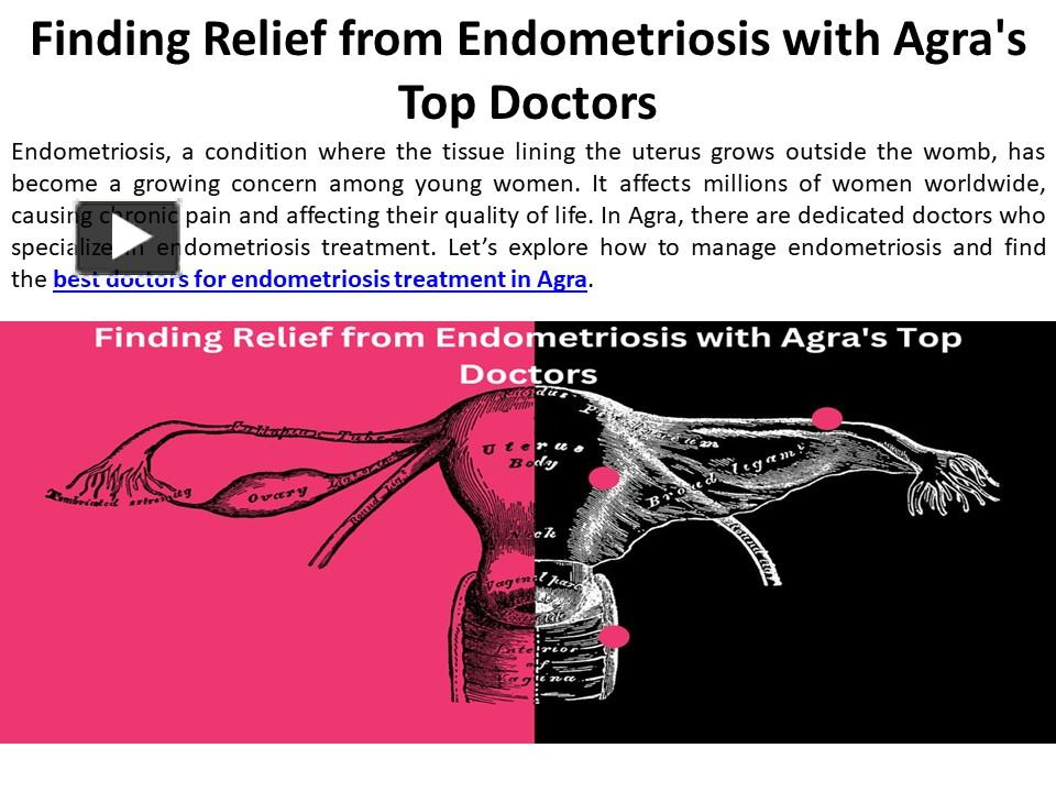 PPT The Top Endometriosis Doctors in Agra PowerPoint presentation free to download id