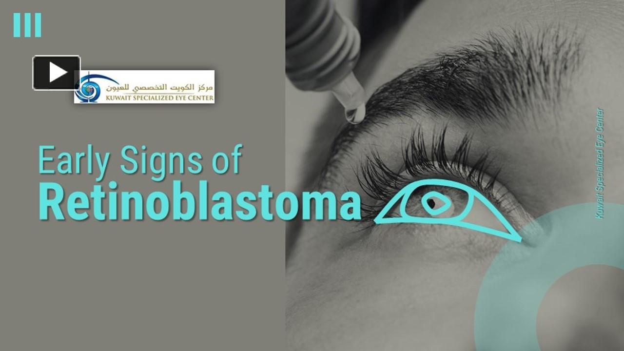 PPT Early Signs of Retinoblastoma PowerPoint presentation free to