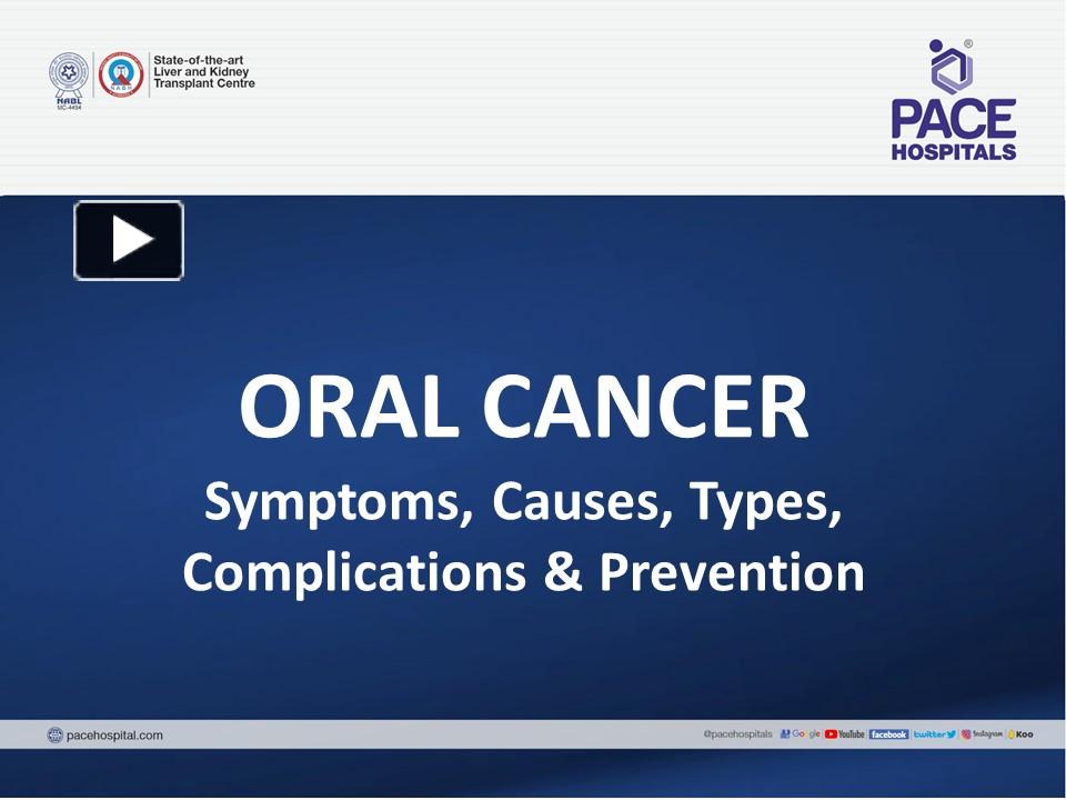 PPT Oral Cancer Symptoms, Causes, Stages, Risk Factors