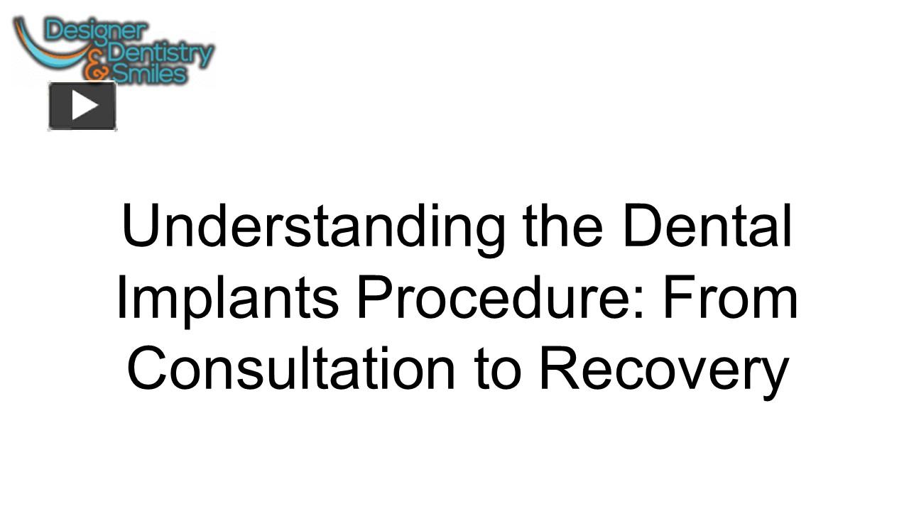 PPT Understanding the Dental Implants Procedure Designer Dentistry