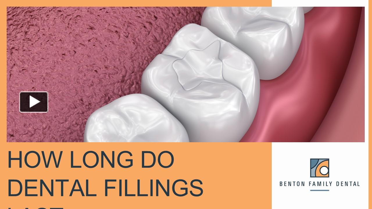 PPT Understanding Dental Fillings How Long Do They Last? PowerPoint