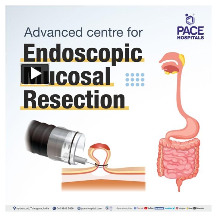 PPT Endoscopic Mucosal Resection (EMR) Procedure Indications & Cost