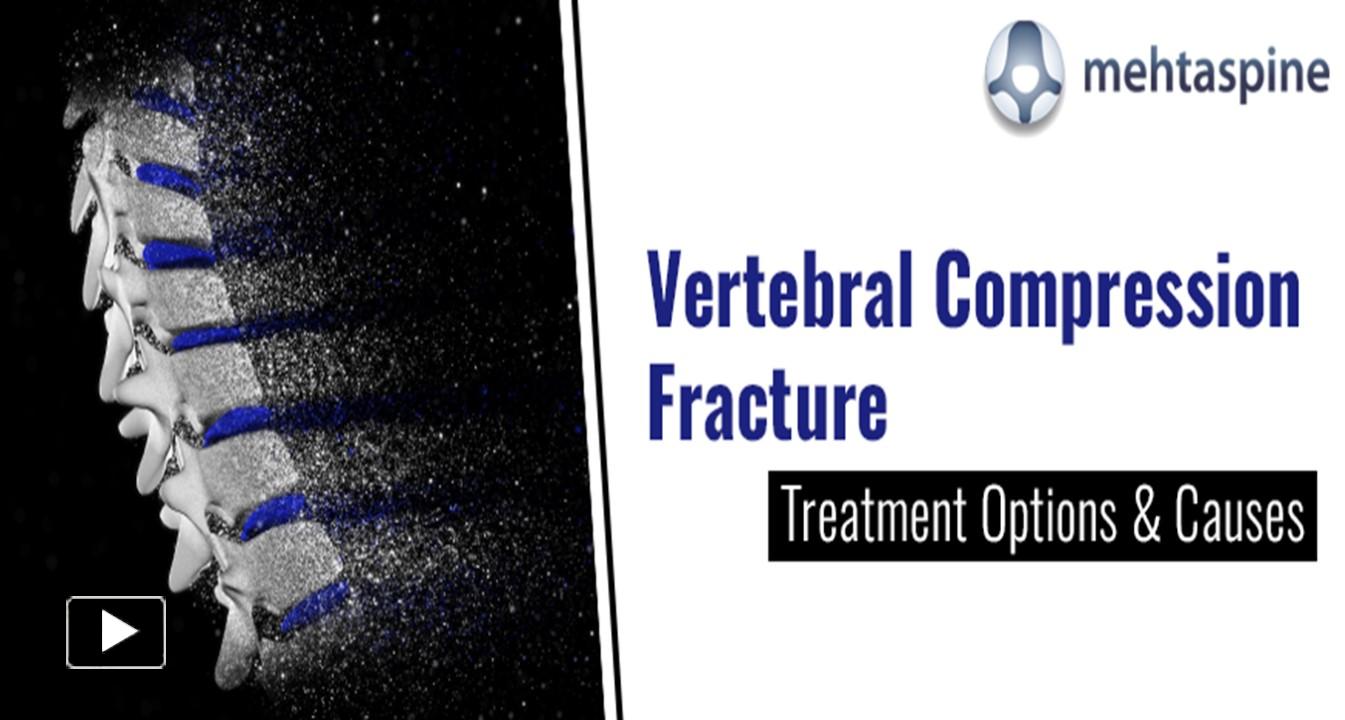 PPT Vertebral Compression Fracture Treatment Options & Causes