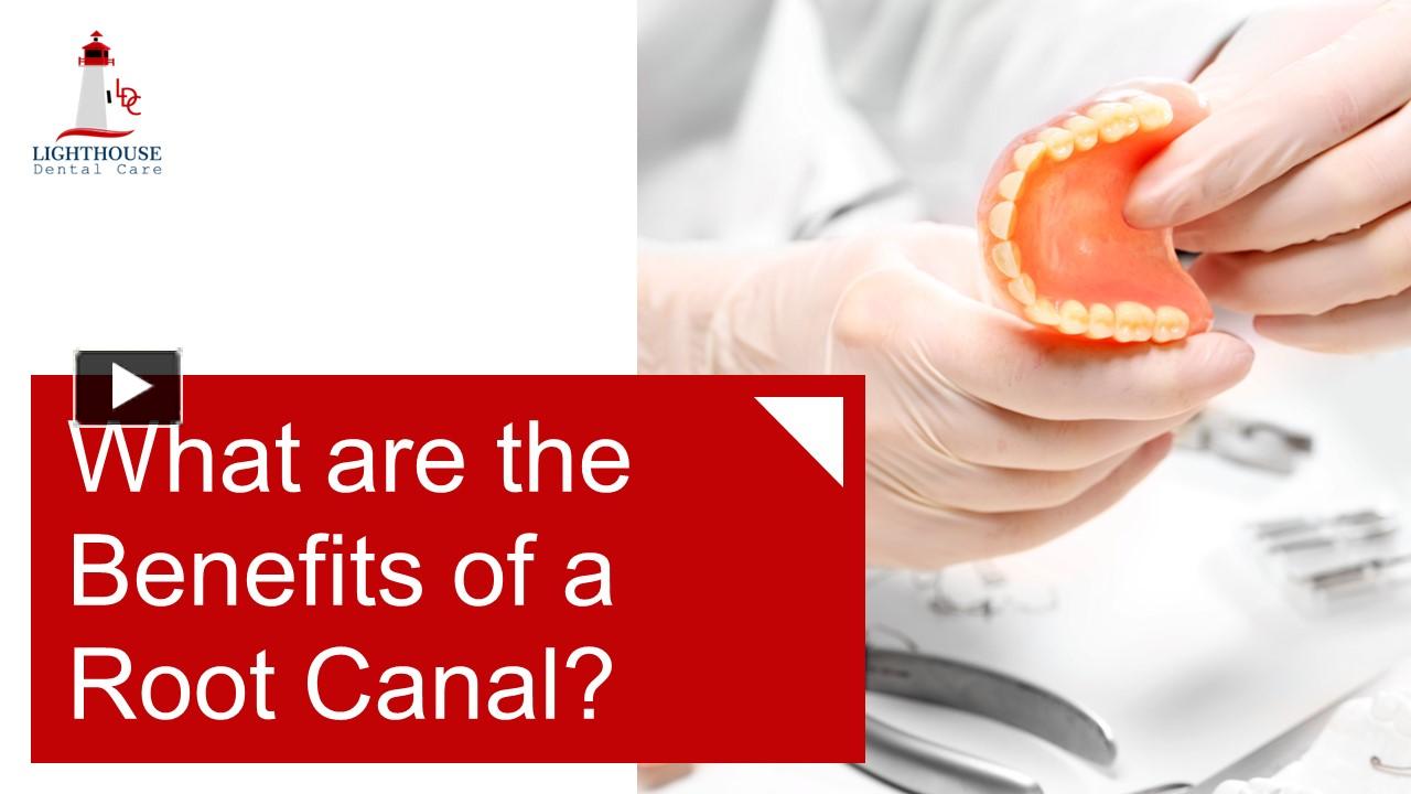 PPT What Are The Benefits Of A Root Canal? PowerPoint presentation