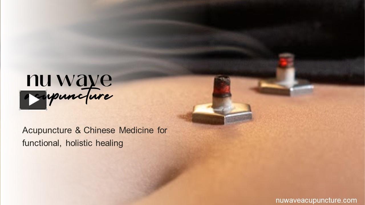 PPT Fertility Acupuncture in Columbus, Ohio Nu Wave Acupuncture PowerPoint presentation