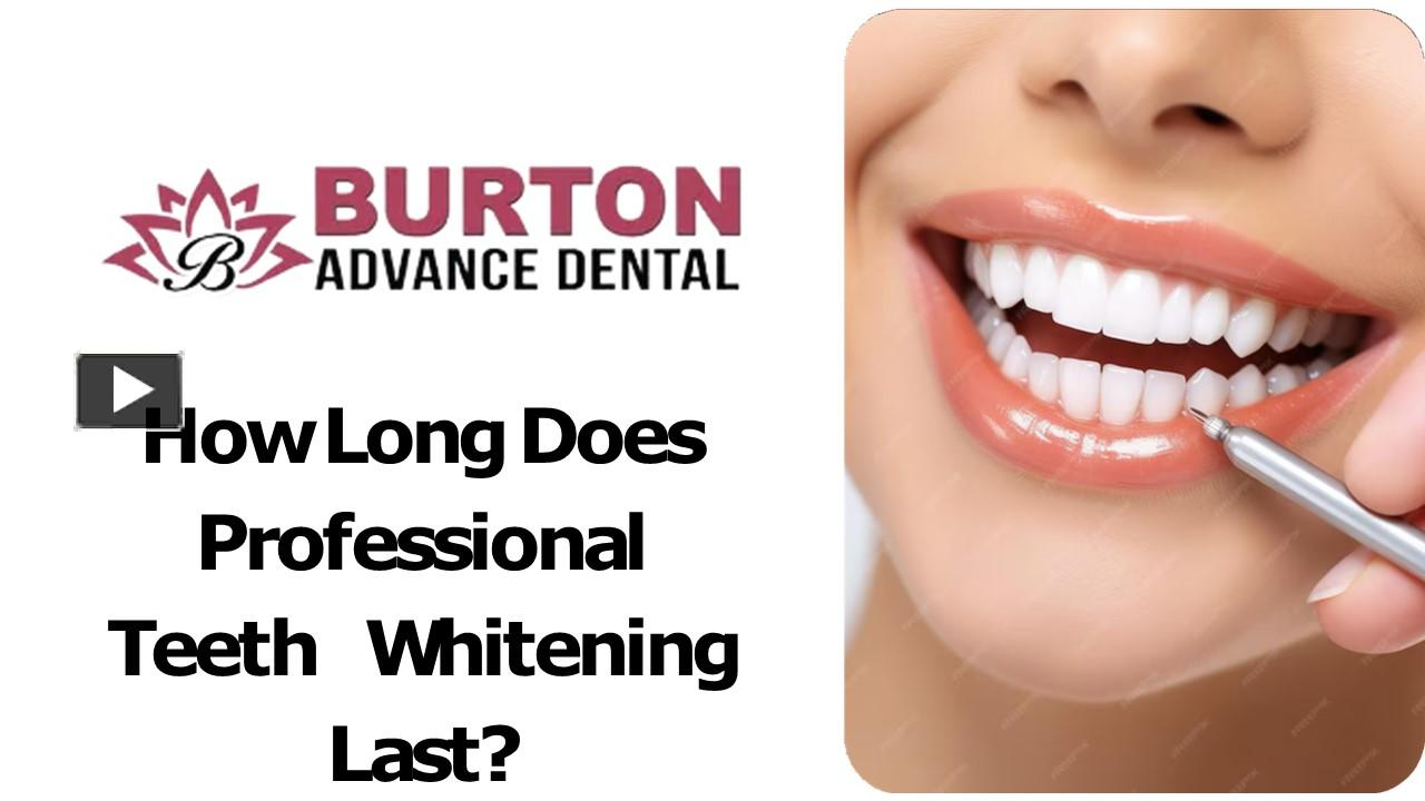 PPT How Long Does Professional Teeth Whitening Last? PowerPoint