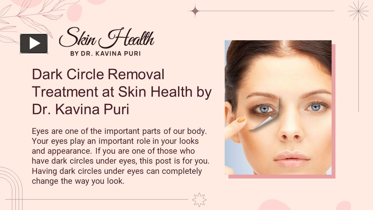 PPT Best Dermatologist for Dark Circles (2) PowerPoint presentation