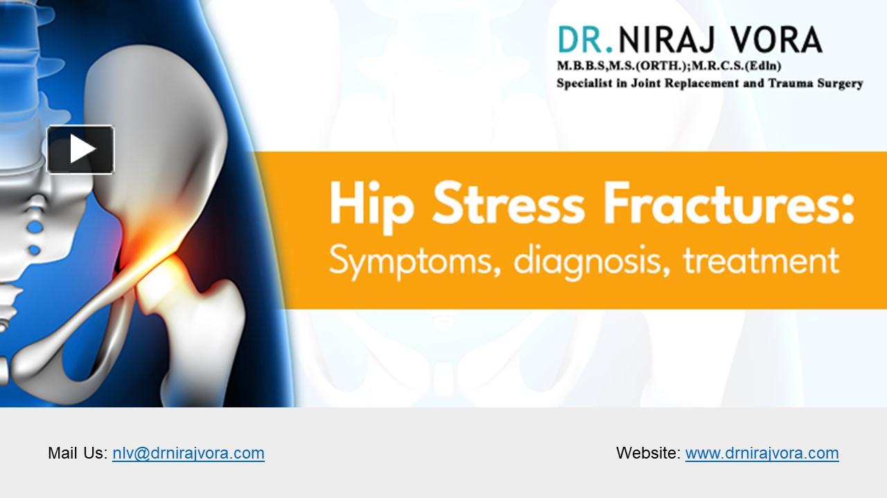 PPT Hip Stress Fractures Symptoms Diagnosis and Treatment Dr Niraj