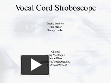 PPT – Vocal Cord Stroboscope PowerPoint presentation | free to view ...