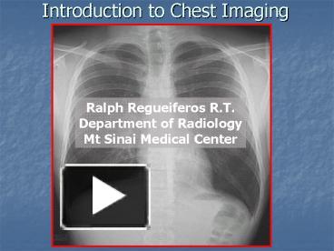 PPT – Introduction to Chest Imaging PowerPoint presentation | free to ...