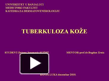 TUBERKULOZA KO presentation | free to download