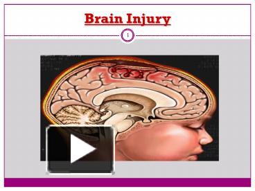 Brain Injury presentation | free to download