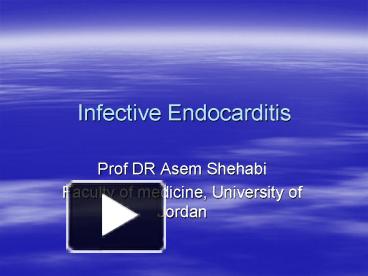 Infective Endocarditis presentation | free to download