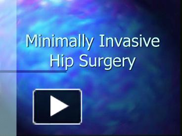Ppt Minimally Invasive Hip Surgery Powerpoint Presentation Free To