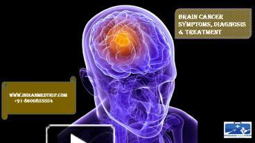 PPT – Brain Cancer-Symptoms,Diagnosis & Treatment PowerPoint ...