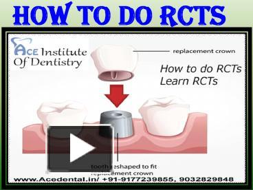 How To Do RCTs And Fees To Learn