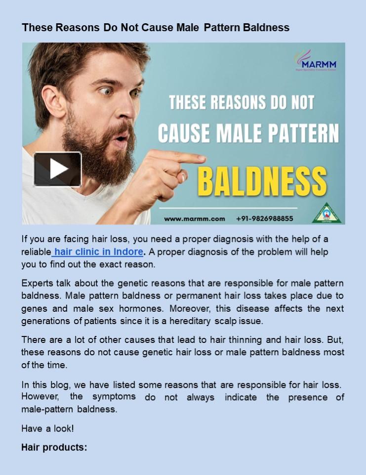 These Reasons Do Not Cause Male Pattern Baldness presentation | free to ...