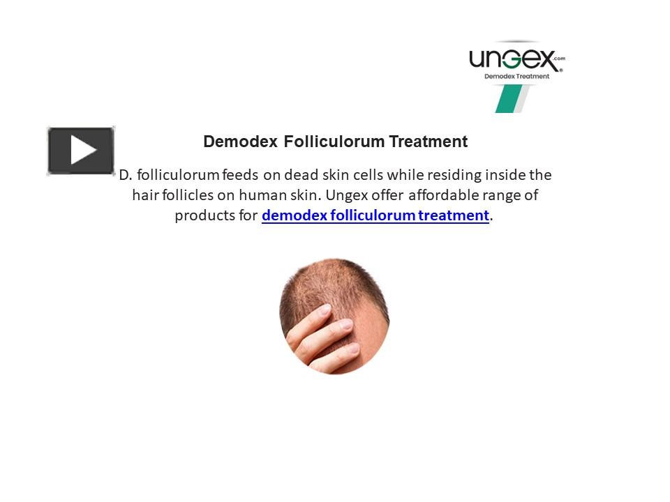 Demodex Folliculorum Treatment presentation | free to download
