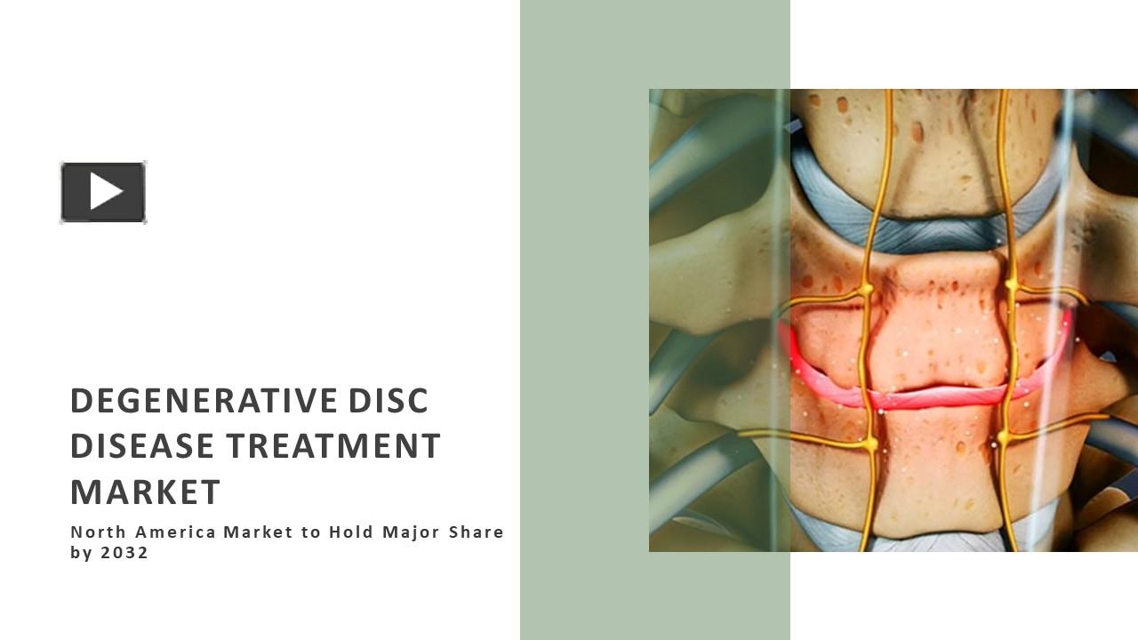 PPT – Degenerative Disc Disease Treatment PowerPoint presentation ...