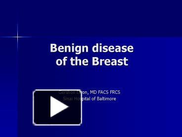 Benign disease of the Breast presentation | free to view